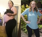 Diana Walton Before and After Bariatric Surgery